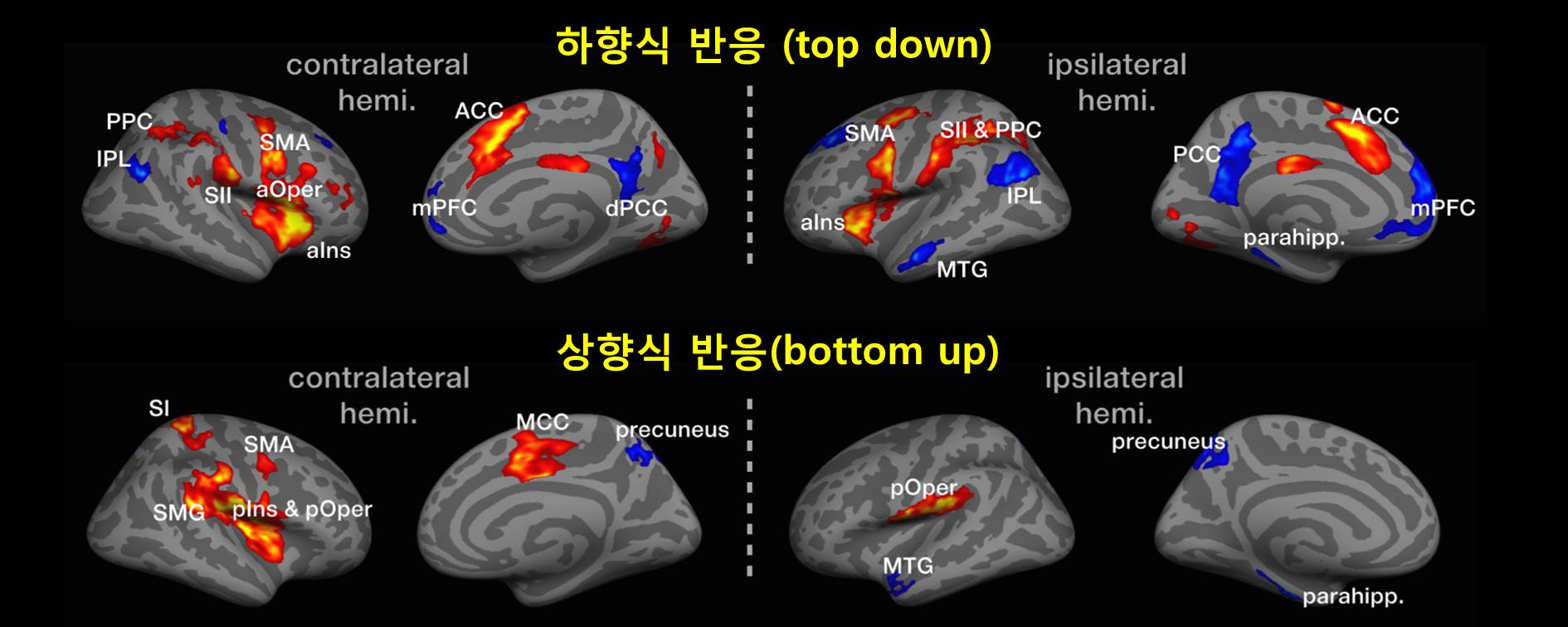 침 자극에 의한 뇌 반응 중 신체 특정 부위 인식 역할 규명 > 뉴스 | 한의신문