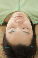 미국의사협회지 “침치료, 편두통 횟수 낮춰준다” 미국 CNN보도