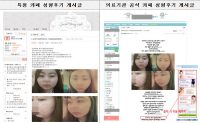 성형 분야 인터넷 후기, 10건 중 3건 이상이 ‘거짓’