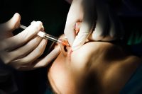 불법 성형 광고에 대부업체 연루까지…성형의사 백태