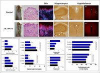 “아토피 피부염, 정신적 스트레스 받으면 더욱 악화된다”