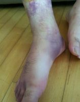 ‘전공의 성추행·폭행’ 5개 병원 무더기 적발…전공의법 시행 후 첫 행정처분