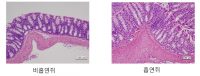 흡연이 대장 염증 유발하는 기전 ‘규명’