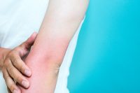 건선 감염되면 당뇨병 발병 위험 높아져