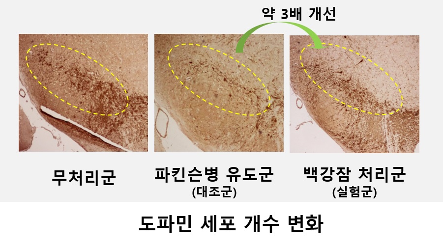 백강잠3(도파민 세포개수 변화 이미지).jpg