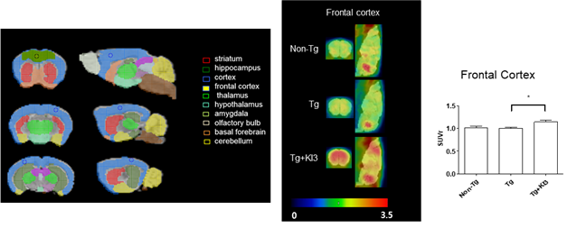 [이미지자료2] 태계혈 전기침 자극으로 알츠하이머 동물의 뇌 대사량 증가.png