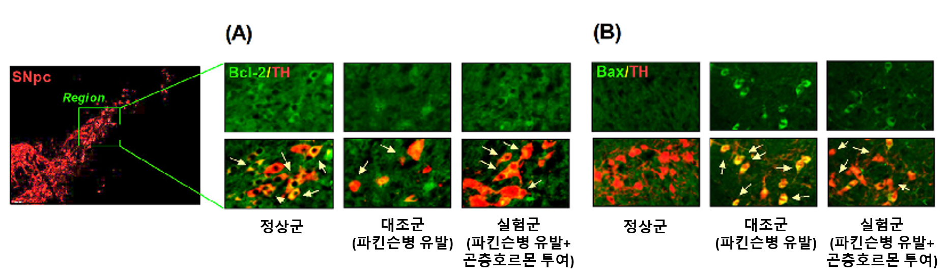 그림3 파킨슨병 유발 동물 모델에서 도파민 세포 내 마이토콘드리아 활동 분석 결과.png