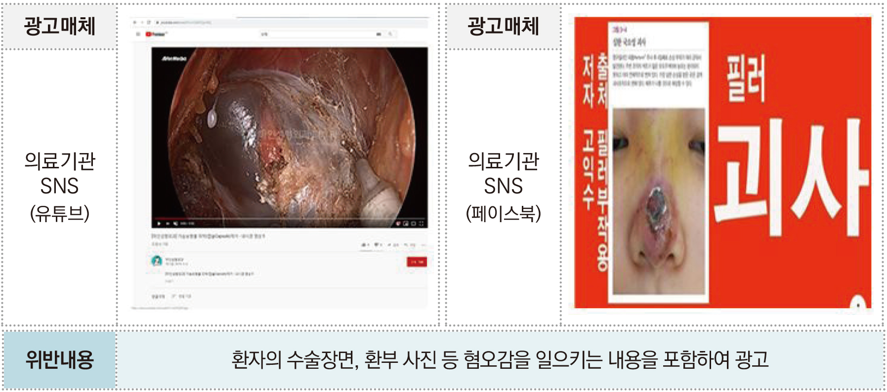 불법 의료광고 주요 유형과 사례 5-2.jpg