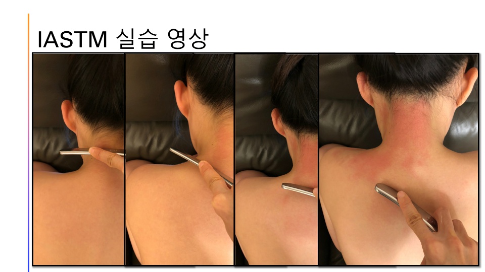 제3강 임산부의 근골격계 통증_반효정_22.jpg