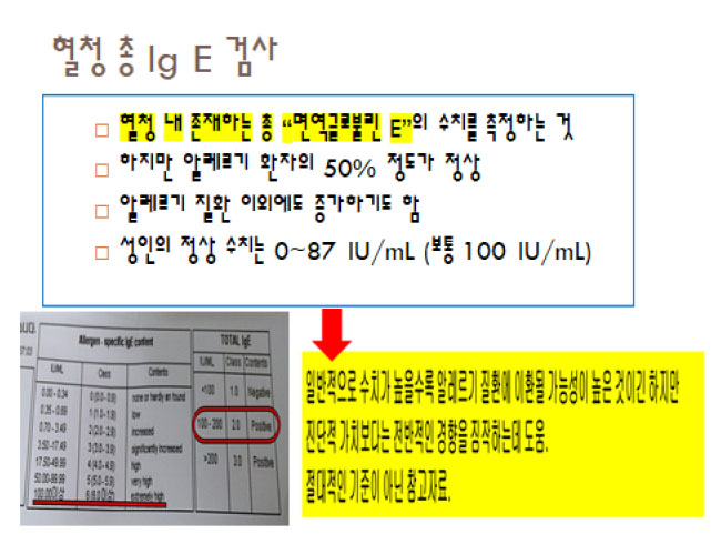 혈청 총 lg E 검사.jpg