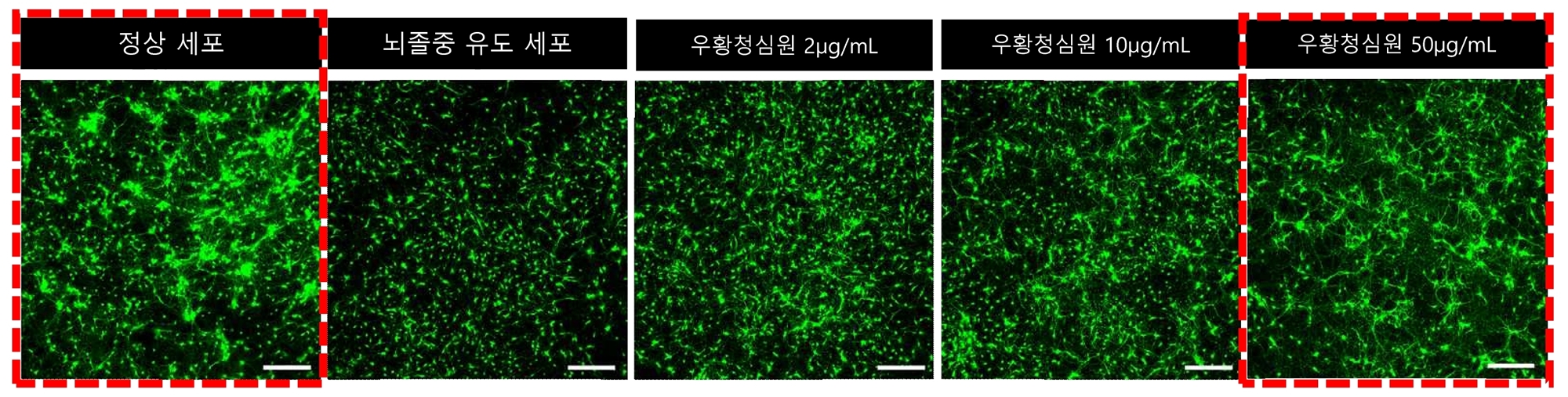 [사진설명] 우황청심원은 농도에 비례해 뇌졸중 상태를 유도한 대뇌피질 신경세포 사멸을 억제했다.jpg