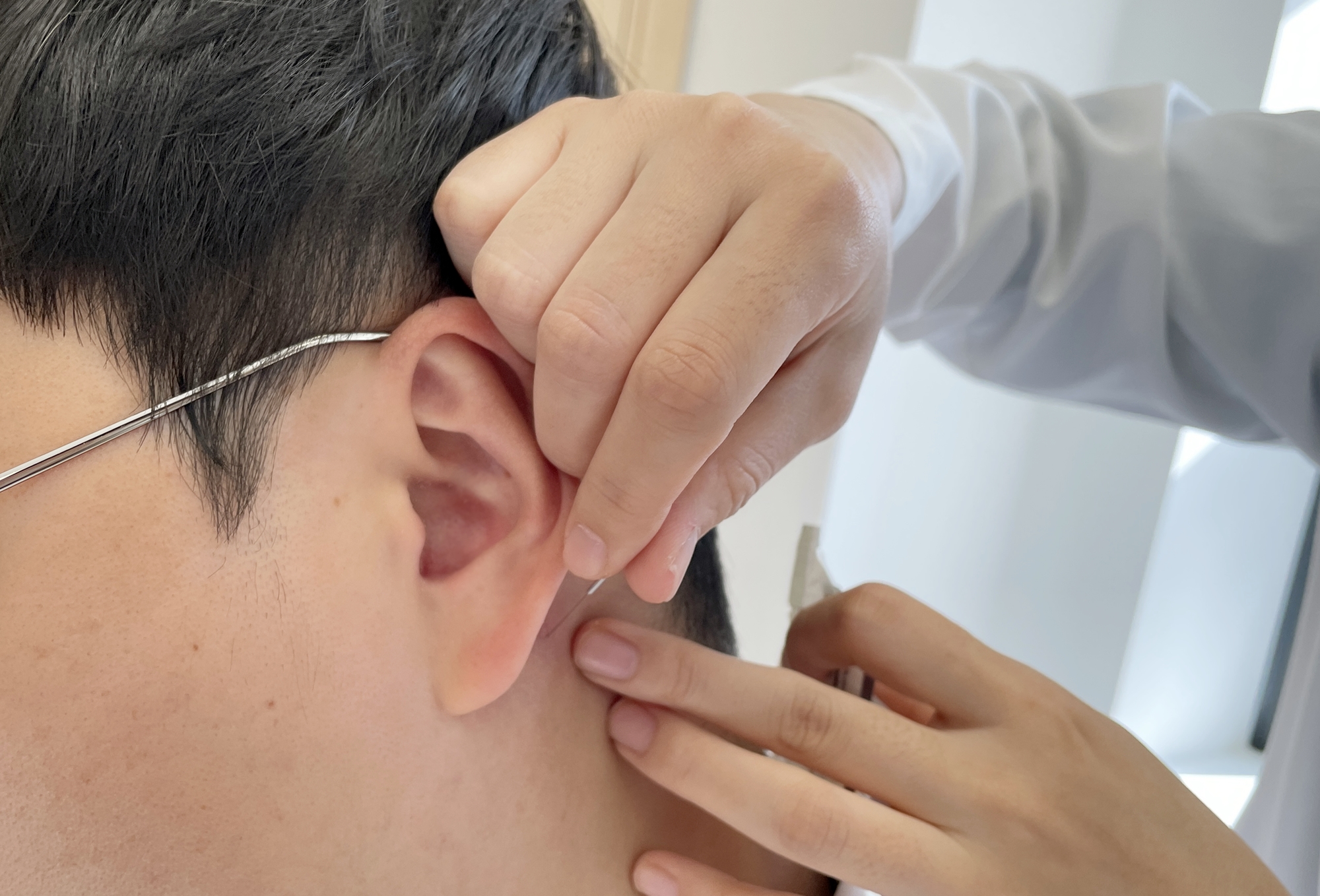 [사진설명] 자생한방병원 의료진이 이명 환자에게 침치료를 하고 있다..jpg