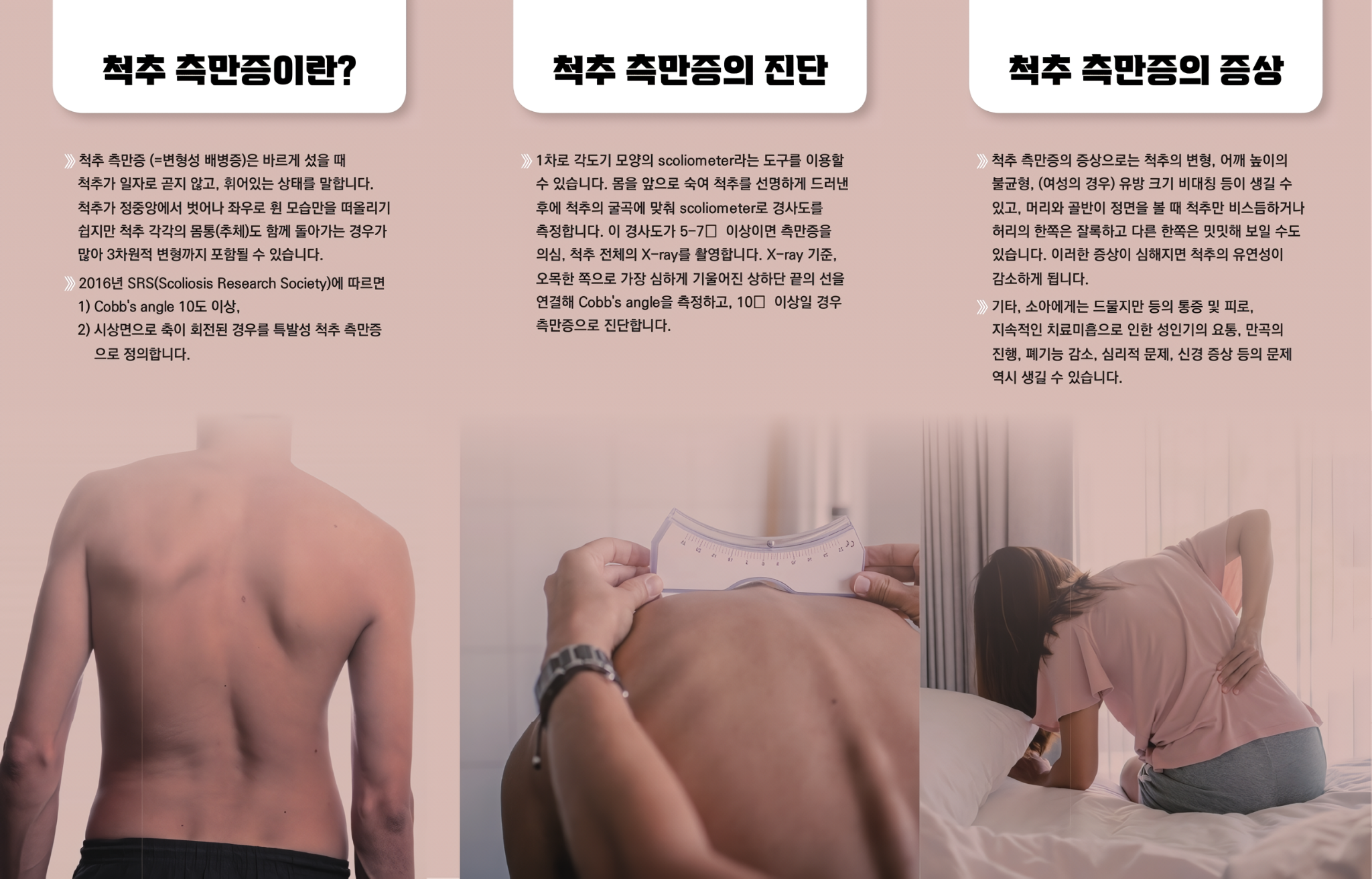 (최종본)척추측만증리플릿_2.png