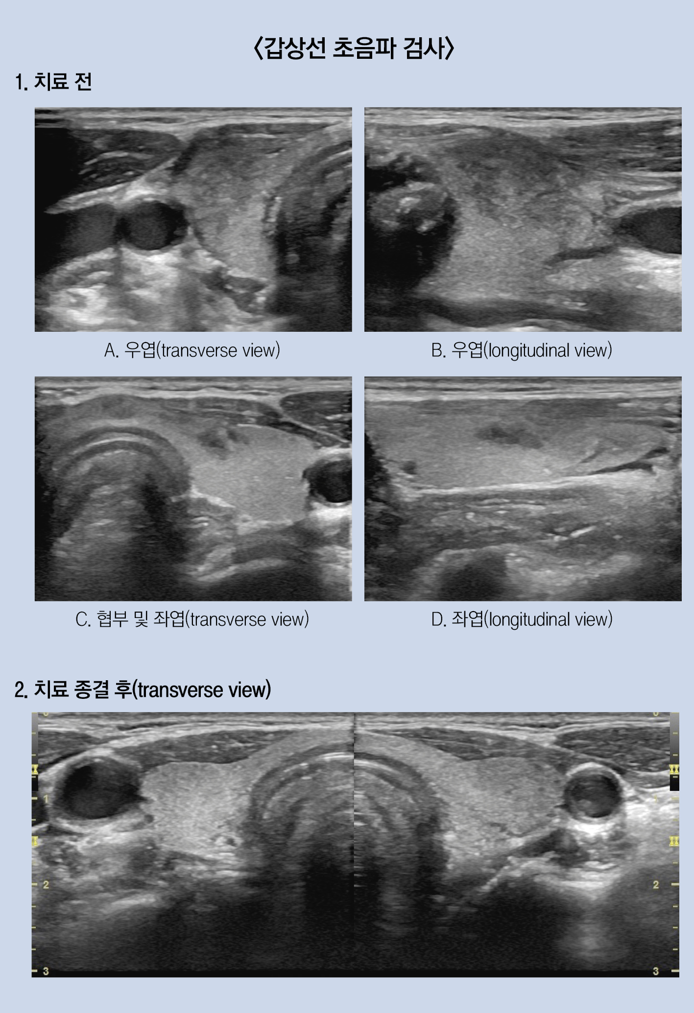 2416-36 이제원.jpg