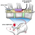 한약재 ‘천수근’ 천연물로 척추관협착증 극복한다