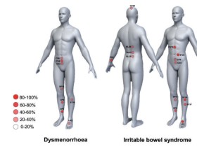 데이터 마이닝 기법으로 통증조절 위한 침 치료 선혈 원리 밝혀내