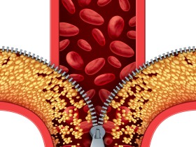 대사증후군 유병률에도 지역 격차가 있다