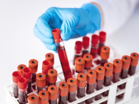 한의사의 혈액검사 활용 현황 및 실태는?