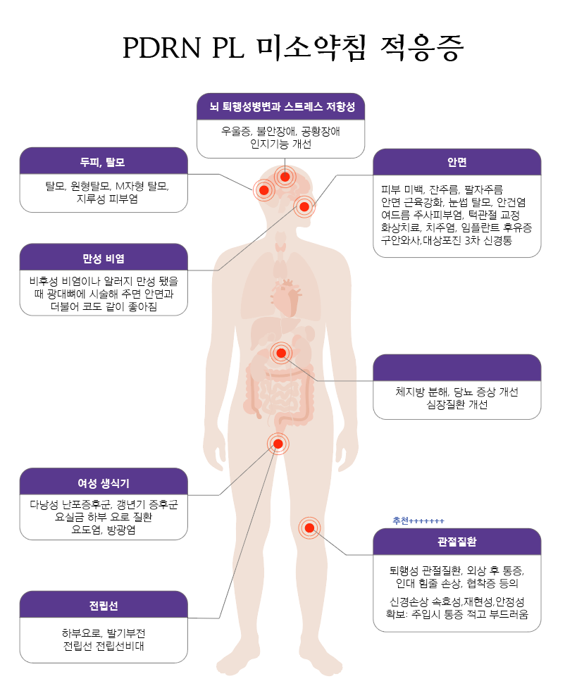 PDRN 약침 3부 3.png