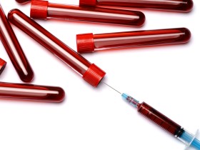 낭비되는 혈액…초과 채혈량 연간 6334L 달해