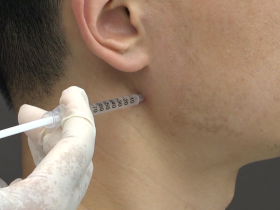 “턱관절 질환, 약침치료가 물리치료보다 경제적”