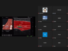 초음파 유도하 약침술의 임상적 접근과 연구 ‘공유’