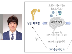 “롱코비드, ‘정신적 피로감’ 두드러져…만성피로증후군 수준”