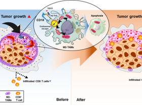암세포 돕는 나쁜 세포만 공격하는 면역항암제 개발