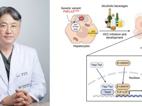 알코올성 간암 발생 촉진하는 유전자 변이 ‘확인’