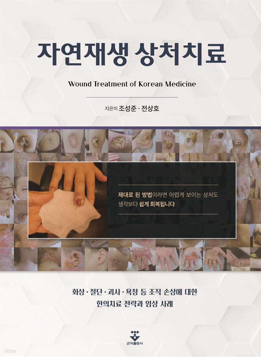 자연재생 상처치료.jpeg