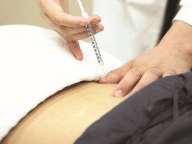 자하거 약침, 척추관협착증 치료 효과 및 안전성 ‘입증’