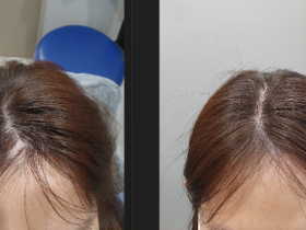 “한의사 배제한 문신사 입법을 규탄한다!”