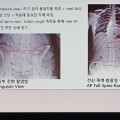 X-ray로 보는 척추 균형…한의공공의료의 진단 패러다임 전환