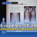 [자막뉴스] X-ray로 보는 척추 균형, 한의공공의료의 진단 패러다임 전환