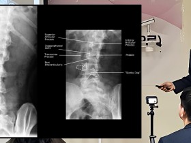 한의사가 직접 찍고 읽는 X-ray, 임상 증례 공유