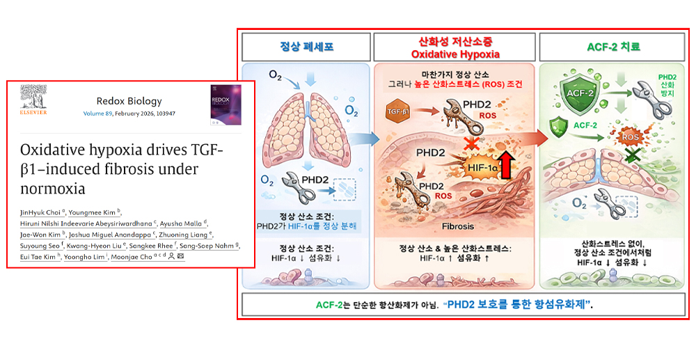 정상 산소에서도 진행되는 폐섬유화의 숨은 원인 첫 규명