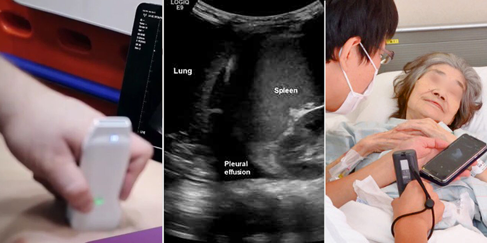 “포터블 초음파, 한의재택의료에 ‘이동성·접근성·즉각성’ 더한 진단도구”