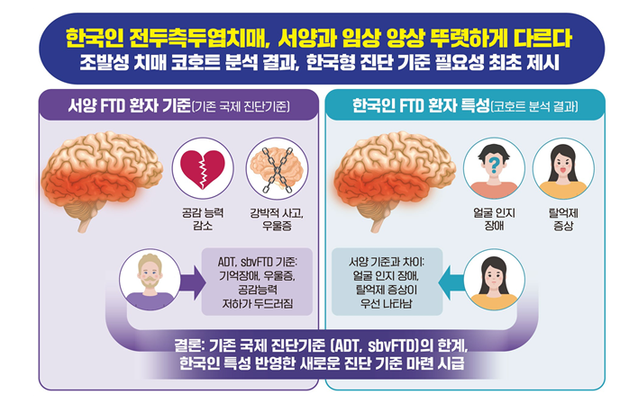 “한국인 전두측두엽치매, 서양과 다르다”