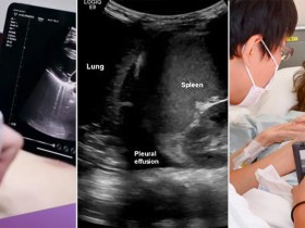 “포터블 초음파, 한의재택의료에 ‘이동성·접근성·즉각성’ 더한 진단도구”