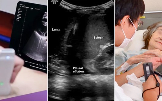 “포터블 초음파, 한의재택의료에 ‘이동성·접근성·즉각성’ 더한 진단도구”