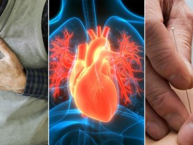 “침 치료, 허혈성 심질환 노인 환자 '5년 사망률' 46%까지 낮춰”