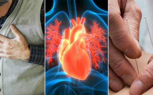 “침 치료, 허혈성 심질환 노인 환자 '5년 사망률' 46%까지 낮춰”