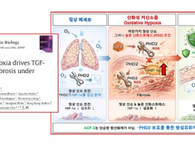 정상 산소에서도 진행되는 폐섬유화의 숨은 원인 첫 규명