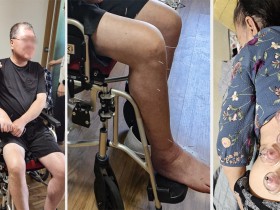 장애인단체 “한의사 포함 ‘완전체 주치의제’ 더 이상 늦춰선 안돼”