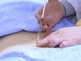 약침치료, 물리치료보다 사회적 비용 낮고 효과 더 높다