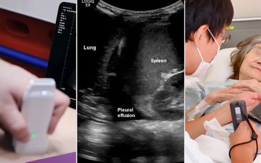 “포터블 초음파, 한의재택의료에 ‘이동성·접근성·즉각성’ 더한 진단도구”