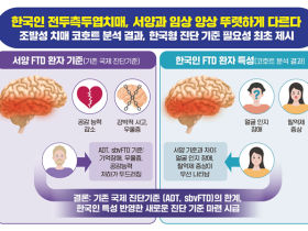 “한국인 전두측두엽치매, 서양과 다르다”