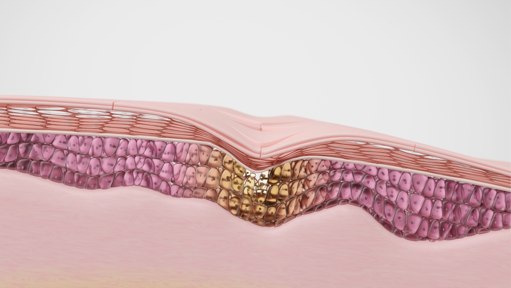 피부과시술 기고문.jpg