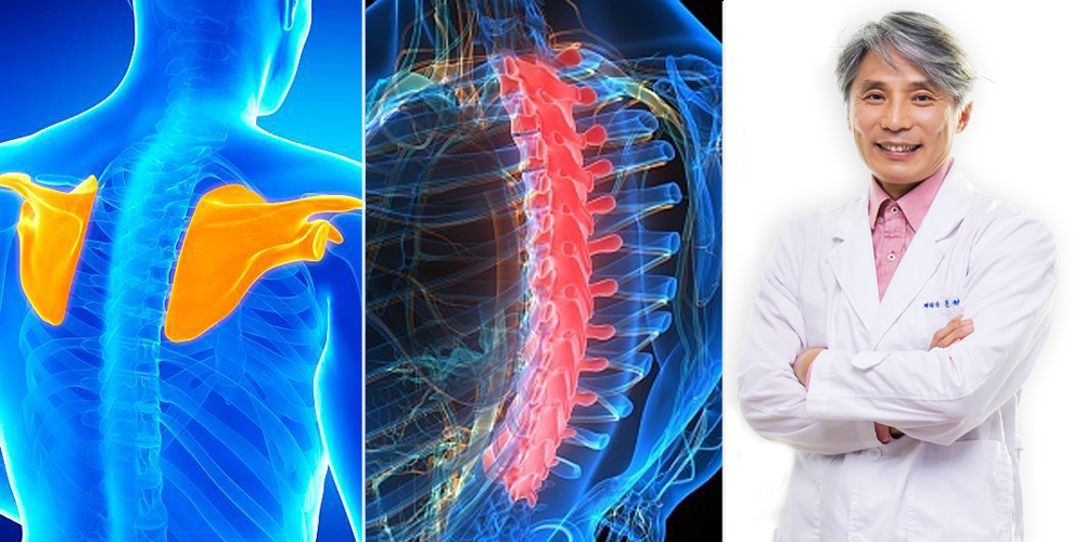 디스크보다 어려운 어깨통증의 ‘숨은 범인’…견갑골·흉추·자세 추적