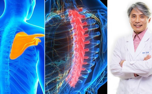 디스크보다 어려운 어깨통증의 ‘숨은 범인’…견갑골·흉추·자세 추적
